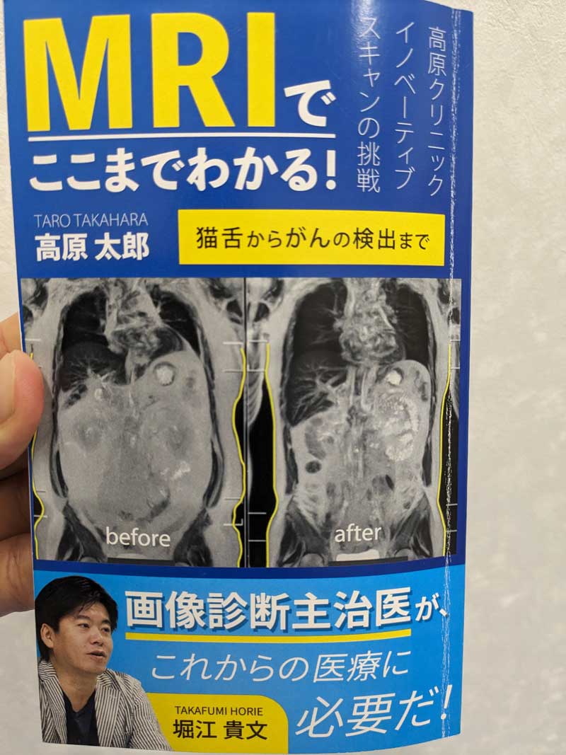 当院の脳ドック